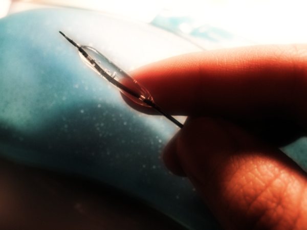 Angioplastica Coronarica